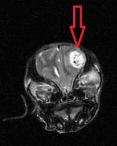 Image of a contrast MRI of a dog brain tumor